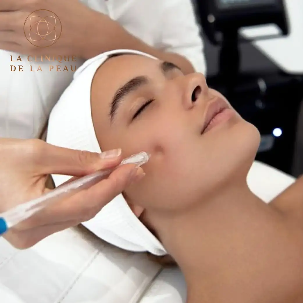 Soin Expert JetPeel revitalisation et hydratation à Nice