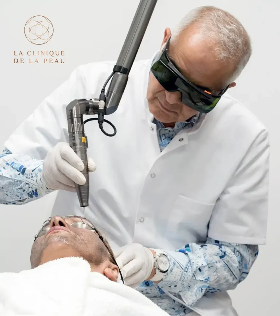 Séance de laser dermatologique pratiquée par le Docteur Khemis pour traiter les cicatrices d'acné à La Clinique de la Peau Nice.