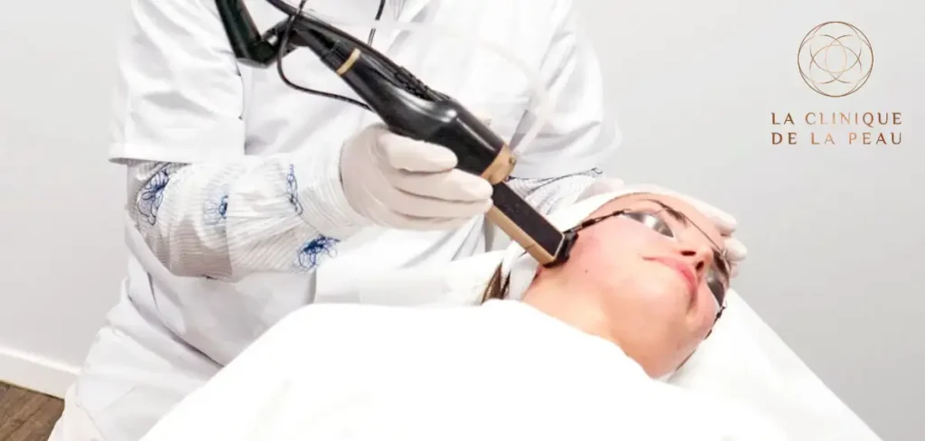 Dermatologue de la Clinique de la Peau soignant les rougeurs du visage d'une patiente avec le laser vasculaire Derma-V.