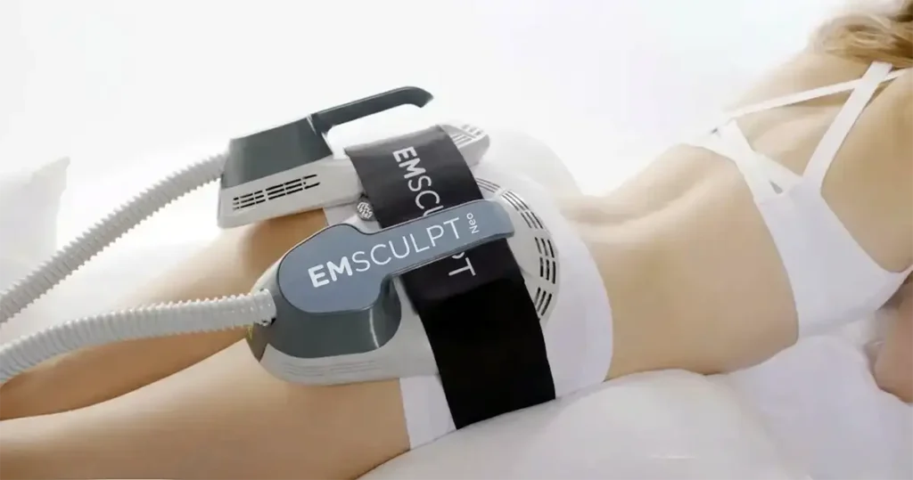 Séance d'Emsculpt Neo sur les fessiers à la Clinique de la Peau à Nice pour un effet lifting sans chirurgie.