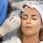 Injections de Botox pour un résultat naturel au niveau du front à la Clinique de la Peau à Nice.