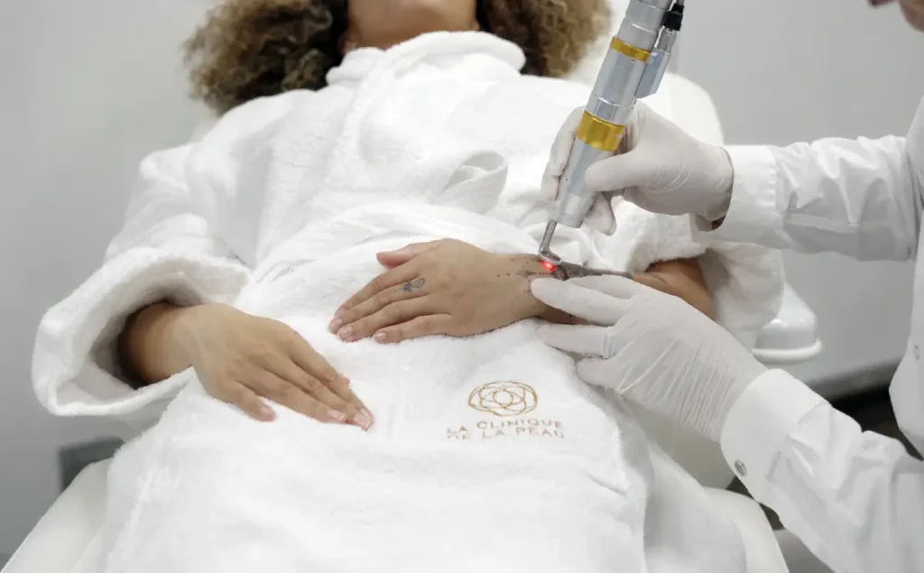 Séance de détatouage laser sur le poignet d'une patiente par un médecin au centre laser Nice de La Clinique de la Peau.