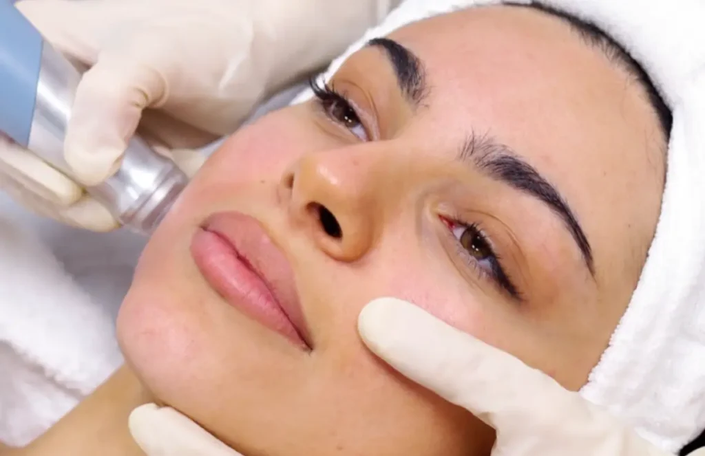 soin visage EmFusion appliqué sur la joue d'une patiente pour restaurer la barrière cutanée à La Clinique de la Peau à Nice.