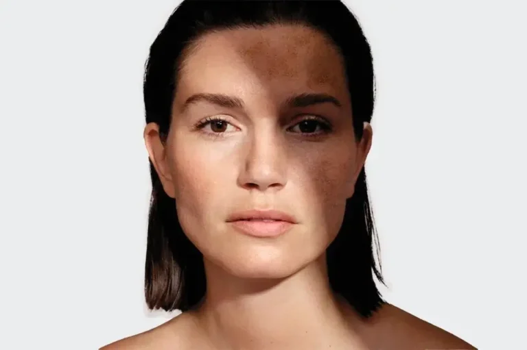 Traitement dermatologique et diagnostic 3D pour réparer sa peau après l'été à Nice